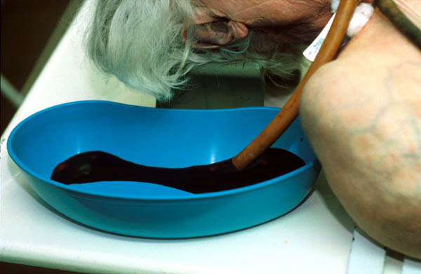 Arterial embalming